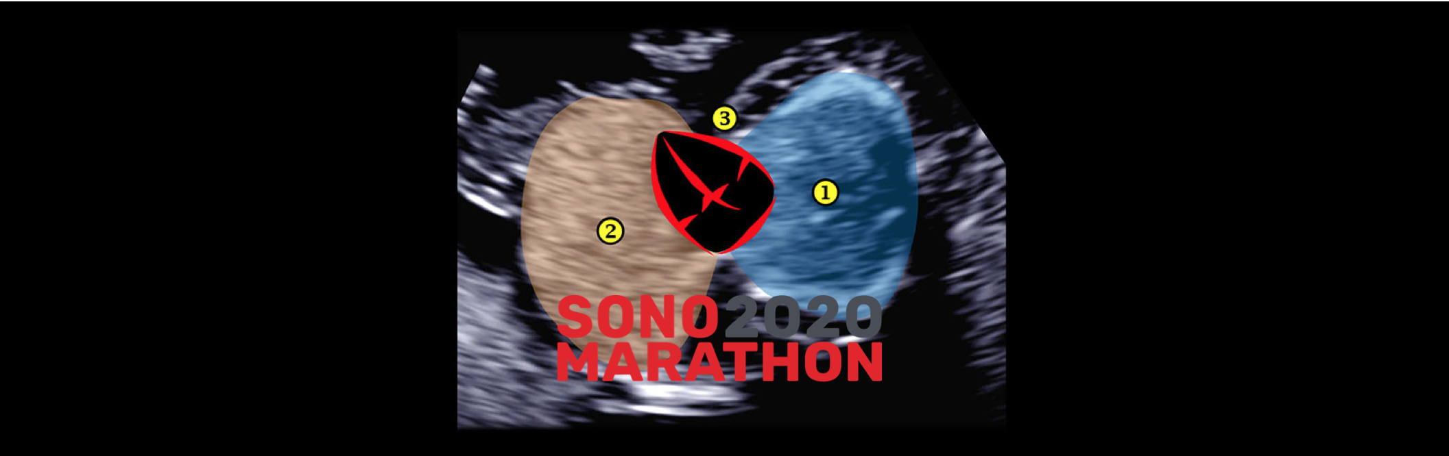 Sonomarathon — 1/4 марафон